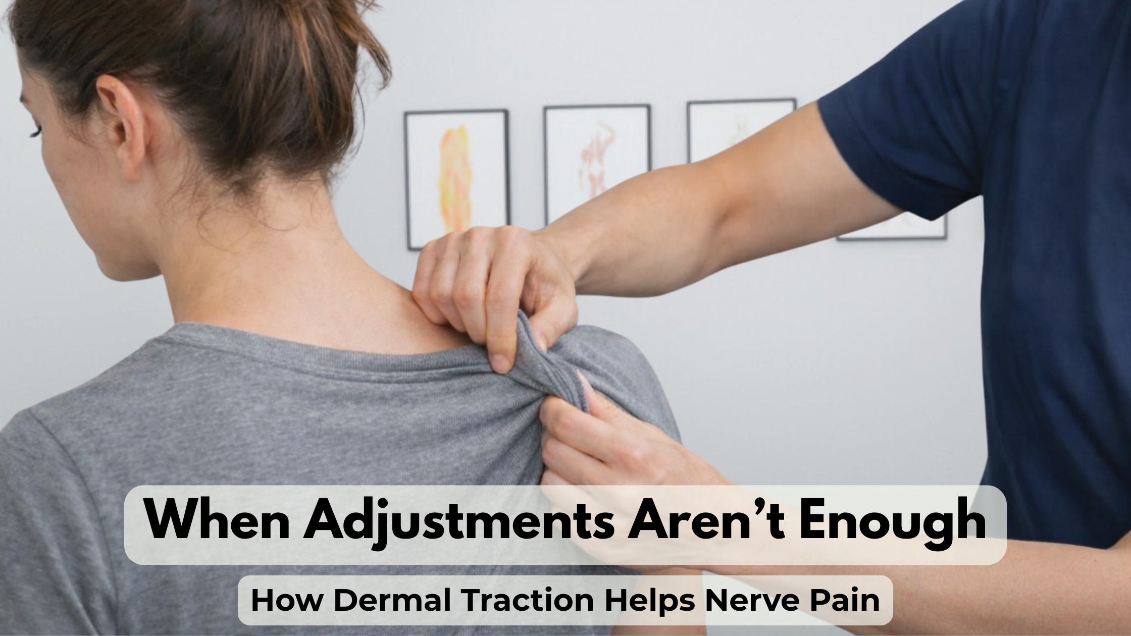 When Adjustments Aren’t Enough: How Dermal Traction Helps Nerve Pain