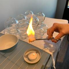 cuppingtherapy2