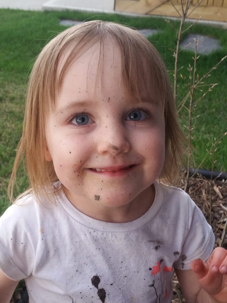 dirt freckles 769x1024